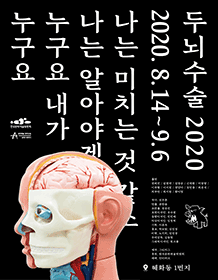 두뇌수술